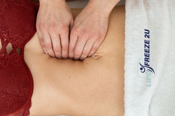 diastasis recti treatment Hassocks