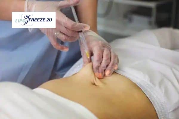 Fat Dissolving Injections Hassocks & Weight loss medication