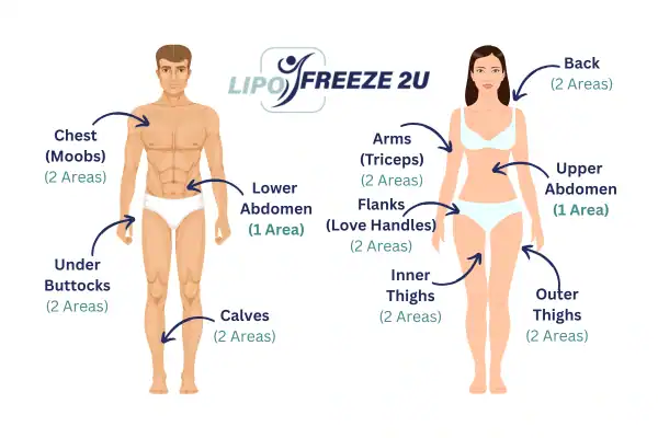 Areas you can have fat freezing treatment Hassocks