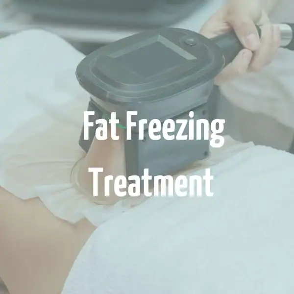 fat freezing treatment Hassocks