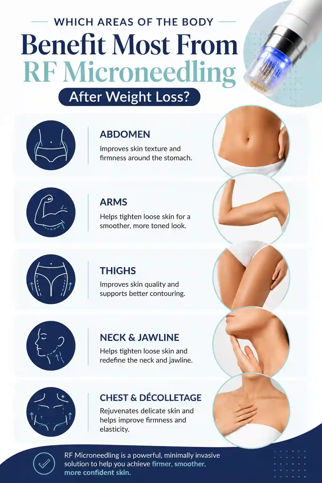 Which Areas of the Body Benefit Most From RF Microneedling After Weight Loss Hassocks